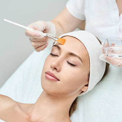 Chemical Peel